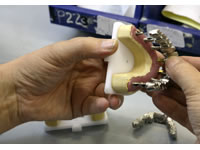 ADG Implants